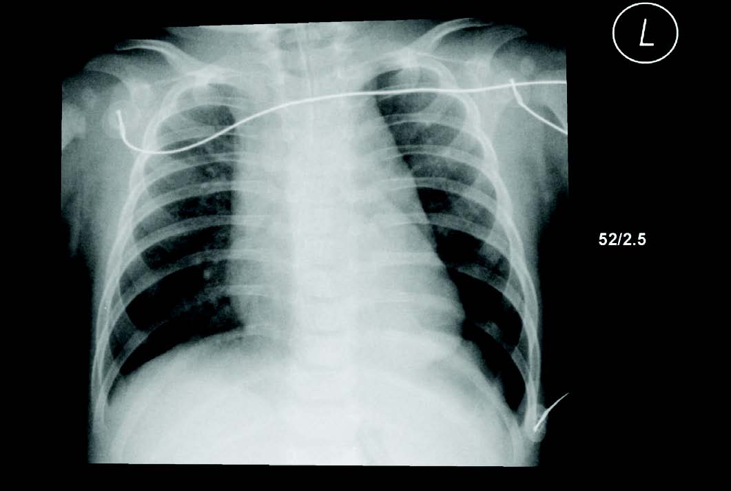 Figure 2 F2